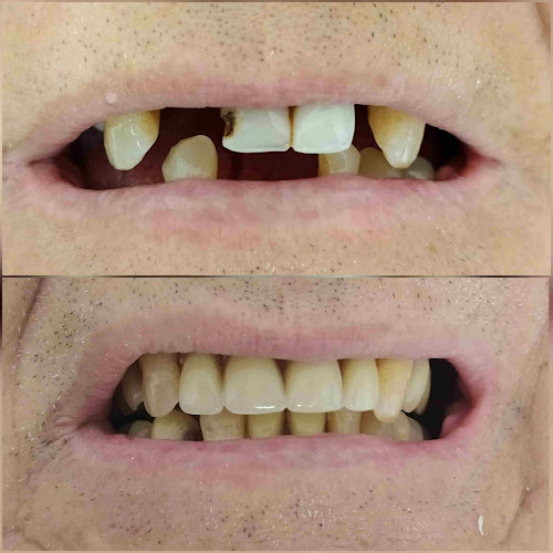 Clínica Dr Andrés Schlosser- Rehabilitación Oral - Implantología - Estética dental - coronas dentales- carillas- Odontología Digital Cerec Cad Cam- Urgencias Dentales- Teleodontología - Dentista