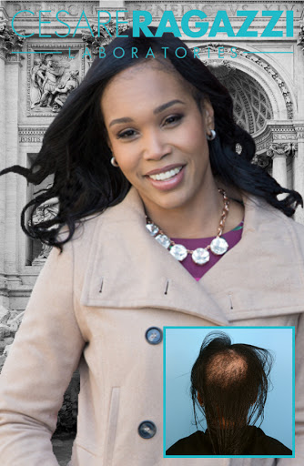 Hair Replacement Service «Elite Solutions Hair Loss Specialists of Sacramento», reviews and photos, 9294 Madison Ave, Orangevale, CA 95662, USA