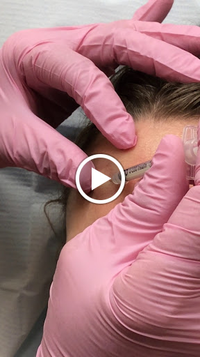 Explore billie eilish tattoos ideas, creative tattoo ideas in Lake Oswego, available at Lake Oswego Vein and Aesthetic LOVA