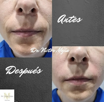 Dr. Mauricio Vergara -Medical Aesthetics Clinic - Dr. Mauricio Vergara -Medical Aesthetics Clinic