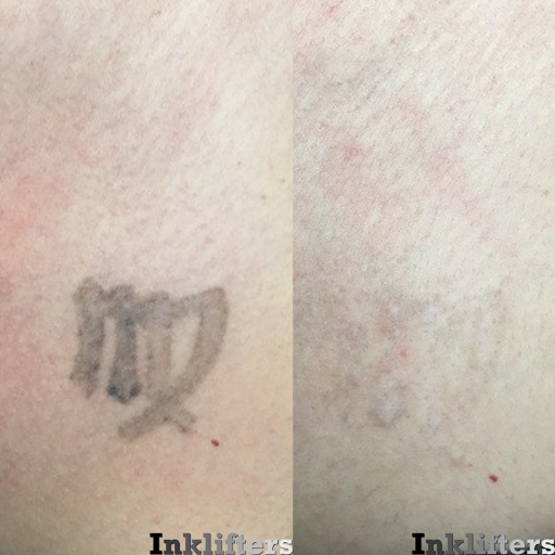 Explore autism tattoo ideas for daughter, creative tattoo ideas in Pleasant Grove, available at Inklifters Tattoo Removal