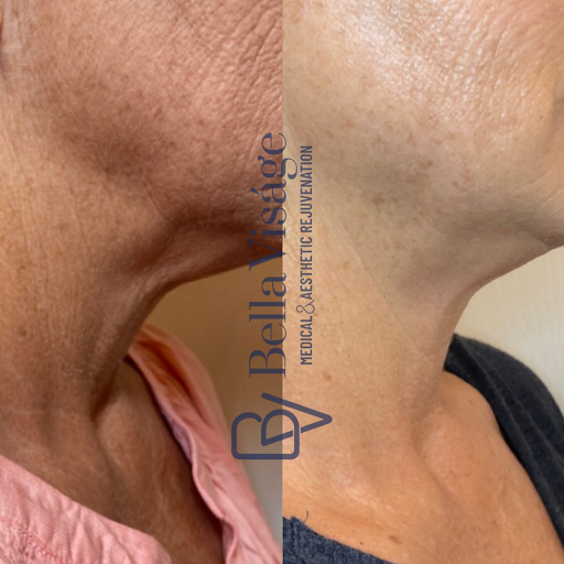 Explore leg tattoo ideas small, creative tattoo ideas in Lakeland, available at Bella Visge Medical & Aesthetic Rejuvenation