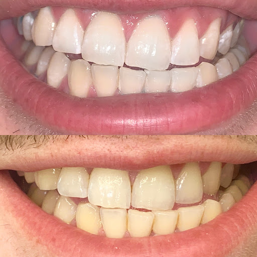 The Teeth Whitening Co. - Prospect