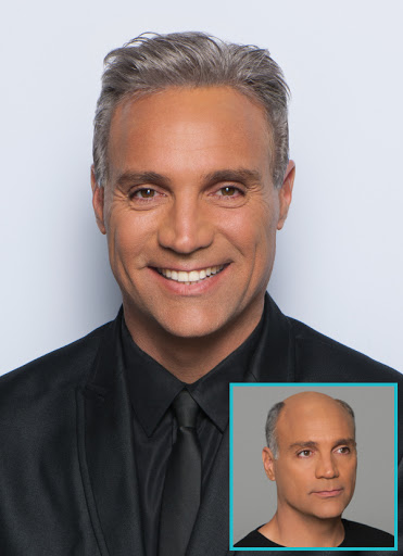 Hair Replacement Service «Elite Solutions Hair Loss Specialists of Sacramento», reviews and photos, 9294 Madison Ave, Orangevale, CA 95662, USA