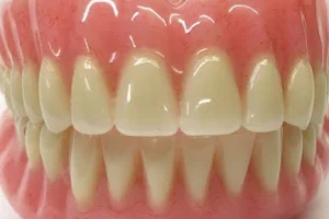 Pusat Senyum Gigi (PEMBUATAN GIGI PALSU , dll) image