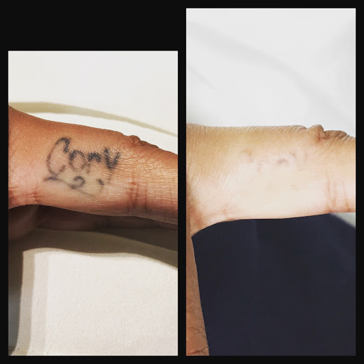 Explore star trek tattoo ideas, creative tattoo ideas in Middle Village, available at Bye Bye Ink Laser Tattoo Removal