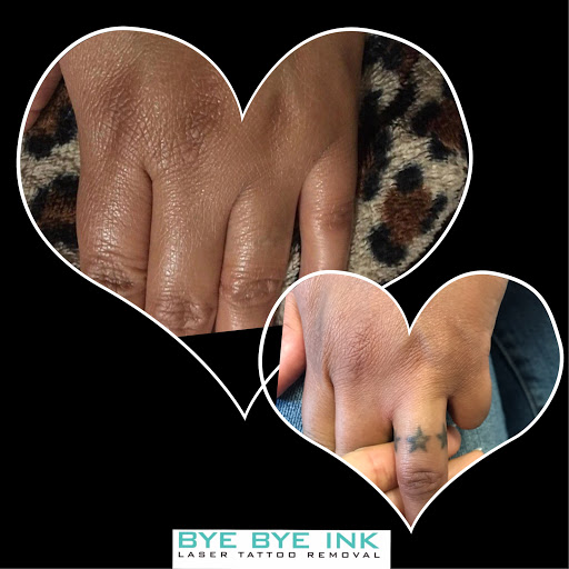 Explore awesome forearm tattoo ideas, creative tattoo ideas in Middle Village, available at Bye Bye Ink Laser Tattoo Removal