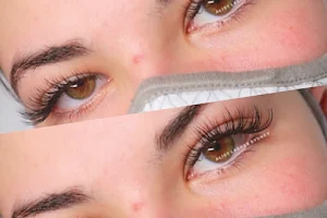 A List Beauty Sydney - eyelash extensions image