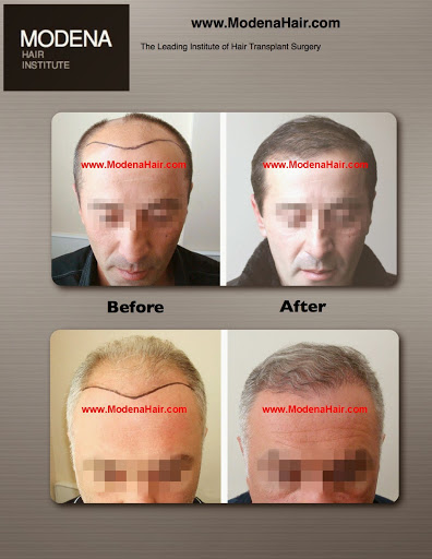 Modena Hair Transplant Institute image