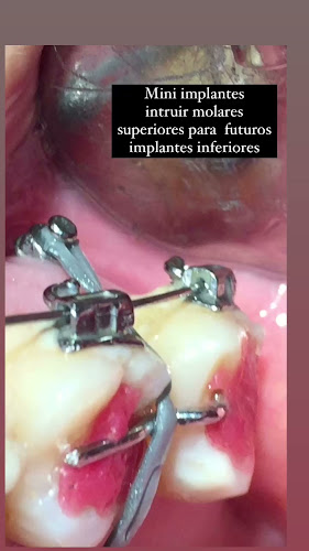 Comentarios y opiniones de ORTOIMPLANT MACHALA ECUADOR. Ortodoncista e Implantóloga Oral. Dra. Mirna Encalada