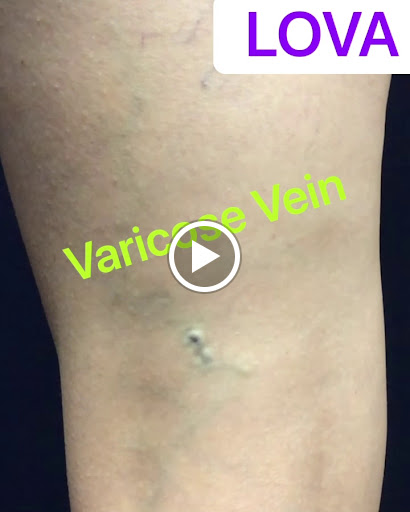 Explore galaxy tattoo ideas, creative tattoo ideas in Lake Oswego, available at Lake Oswego Vein and Aesthetic LOVA