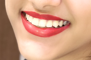 Smilesparks Dental & Orthodontic Hospital | Invisalign Studio| image