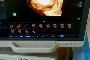 Muneni Medical Ultrasound image