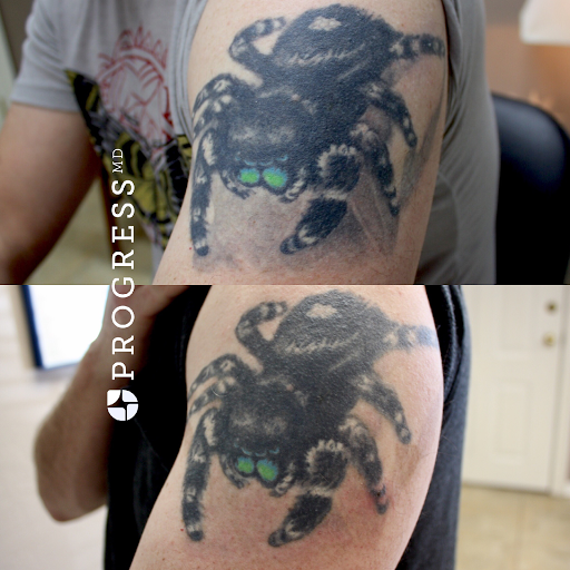Explore lower back tattoo ideas for females, creative tattoo ideas in Amarillo, available at Progress MD Tattoo Removal