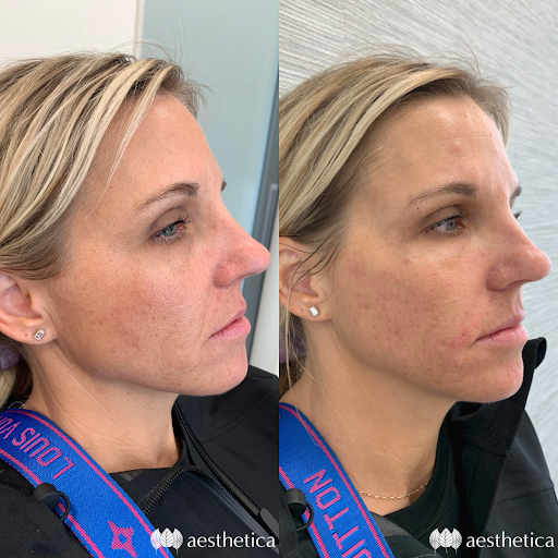 Explore kappa alpha psi tattoo ideas, creative tattoo ideas in Pleasant Grove, available at Aesthetica