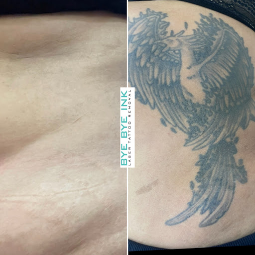 Explore tattoo ideas for life, creative tattoo ideas in Middle Village, available at Bye Bye Ink Laser Tattoo Removal