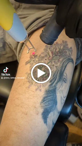 Explore lady ankle tattoo ideas, creative tattoo ideas in Reno, available at Reno Tattoo Removal