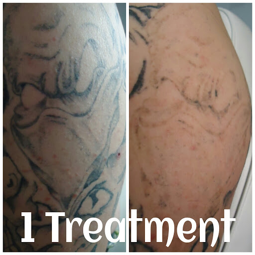 Explore soulmate tattoo ideas, creative tattoo ideas in Reno, available at Reno Tattoo Removal