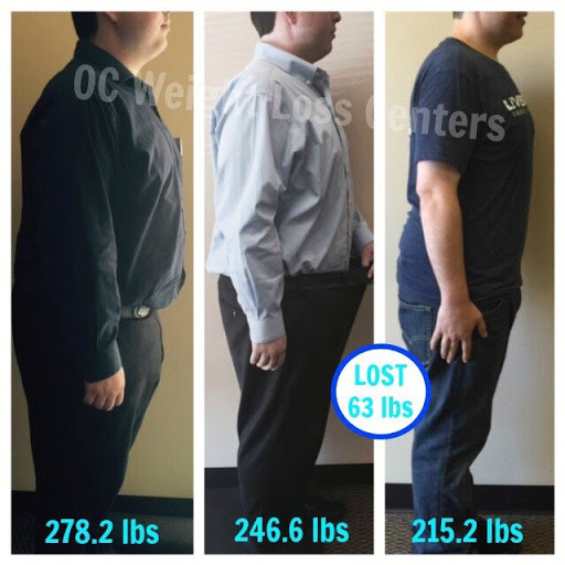 OC Weight Loss Centers & CoolSculpting image
