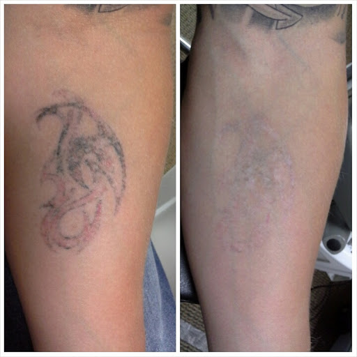 Explore cover up tattoo ideas on forearm, creative tattoo ideas in Plymouth, available at Blue Jacket Tattoo Company and Laser Removal