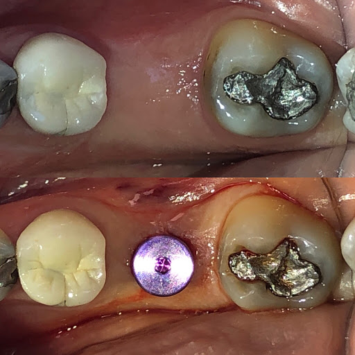 Contemporary Periodontics & Dental Implants