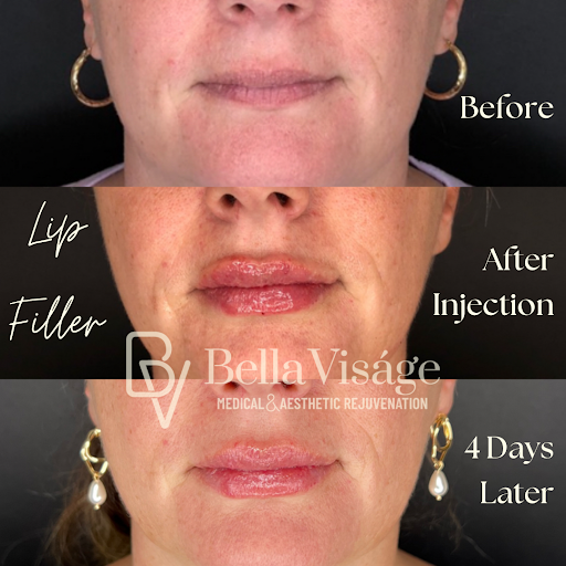 Explore small dog tattoos ideas, creative tattoo ideas in Lakeland, available at Bella Visge Medical & Aesthetic Rejuvenation