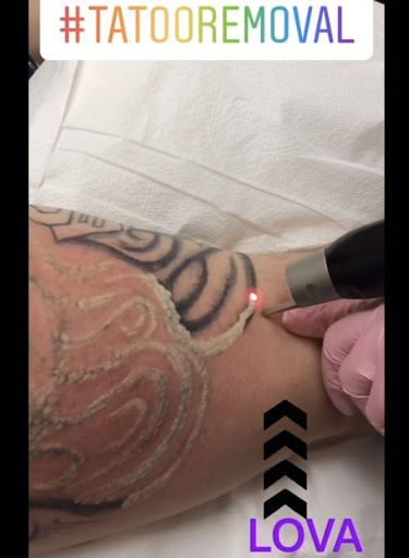 Explore templar tattoo ideas, creative tattoo ideas in Lake Oswego, available at Lake Oswego Vein and Aesthetic LOVA