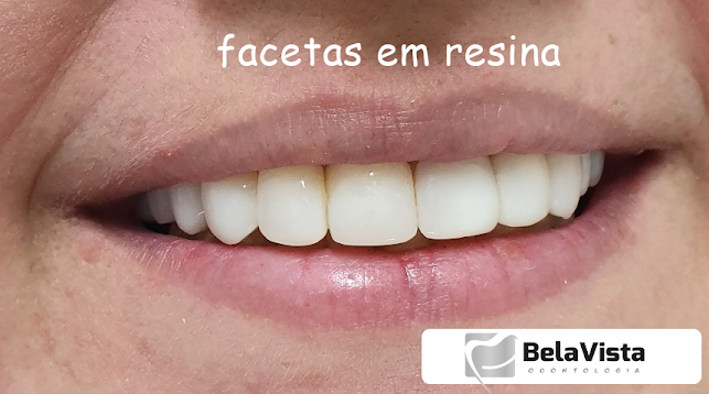 Bela Vista | Dentista Porto Alegre - Porto Alegre