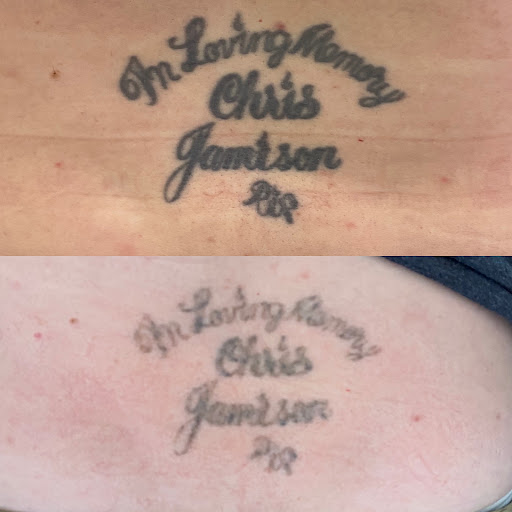 Explore florida gator tattoo ideas, creative tattoo ideas in Lake Jackson, available at Second Chance Laser Tattoo Removal