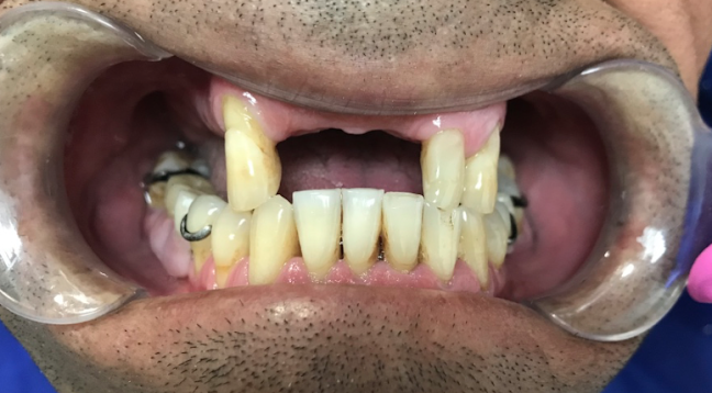 CLINICA DENTAL ALTO OLIVAR - Dentista
