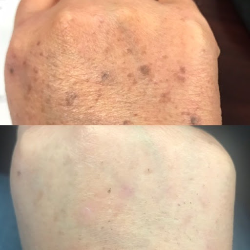 Fakheri Azita MD - Dermatologist in Tarzana image