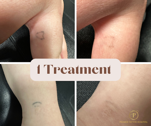 Explore grandpa tattoo ideas small, creative tattoo ideas in Mckinney, available at Premier Tattoo Removal