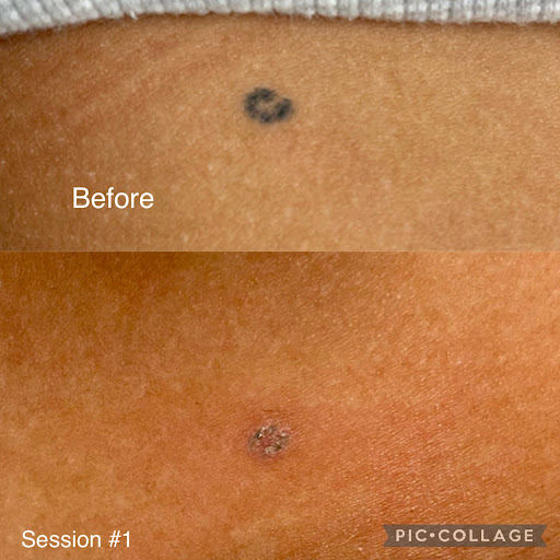 Explore tattoo ideas for ladies back, creative tattoo ideas in Savannah, available at Haute Brows. Cosmetic Tattoo