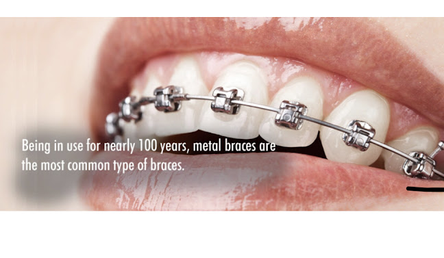 ODL Dental Clinic - Orthodontics - Braces London - London