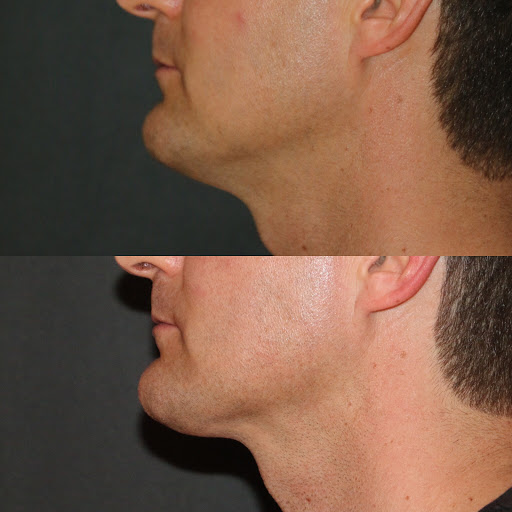 Explore november tattoo ideas, creative tattoo ideas in Summit, available at Ethos Aesthetics and Wellness, Laser Hair Removal and Med Spa