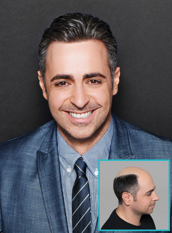 Elite Hair Loss Solutions 95670
