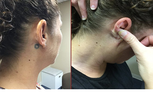 Explore ace tattoo ideas, creative tattoo ideas in Omaha, available at Enlighten Omaha