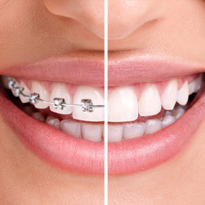 Opinii despre Dr. Leia Tvigun - Medic Ortodont în <nil> - Dentist