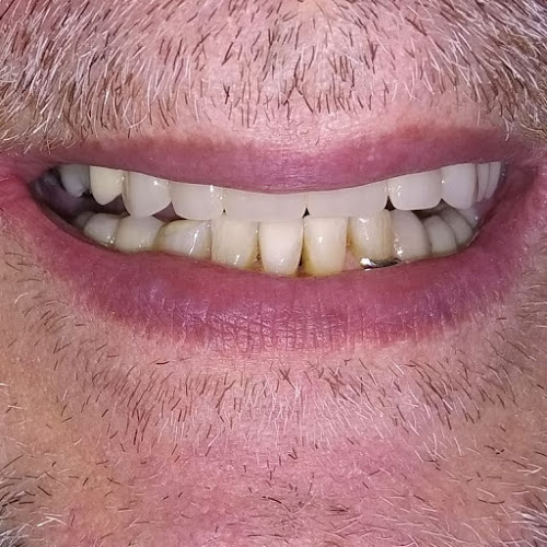 Opiniones de Consultorio Odontológico Dra. Ana Lía Font en Canelones - Dentista