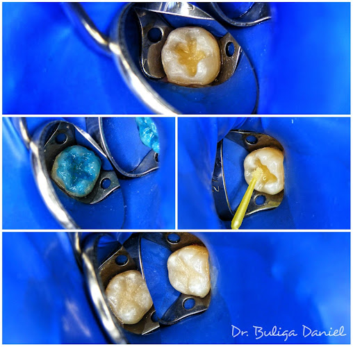 Opinii despre Cabinet Stomatologic -Microscopie Dentara Dr. Buliga Daniel în <nil> - Dentist