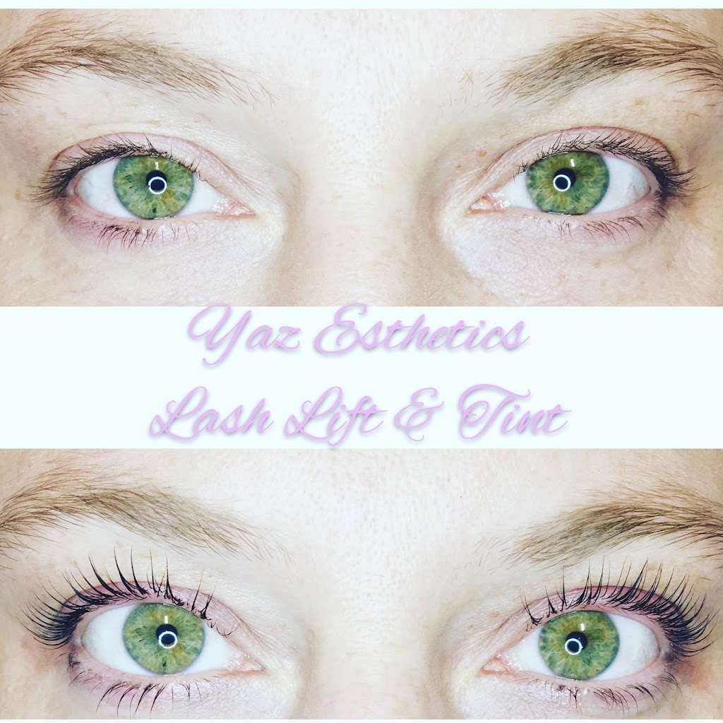 Yaz Esthetics 55435