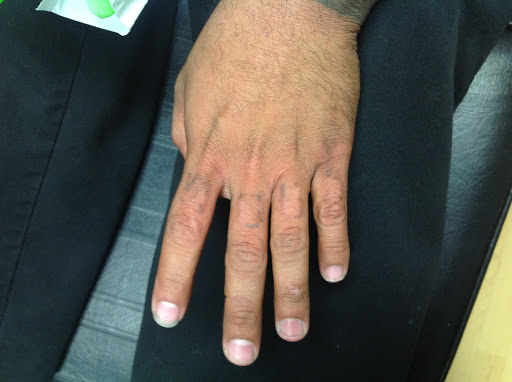 Explore negative space tattoo ideas, creative tattoo ideas in Honolulu, available at Way Gone Laser Tattoo Removal