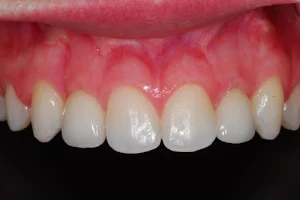 Smile Design - Dental implants Christchurch image