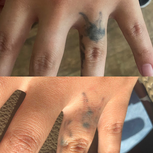 Explore small tattoo ideas neck, creative tattoo ideas in Lake Jackson, available at Second Chance Laser Tattoo Removal