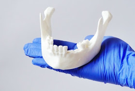 threeD MED - Diseño e impresión 3D para Medicina y Odontología