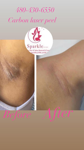 Explore e tattoo ideas, creative tattoo ideas in Tempe, available at Sparkle Laser HairTattoo Removal