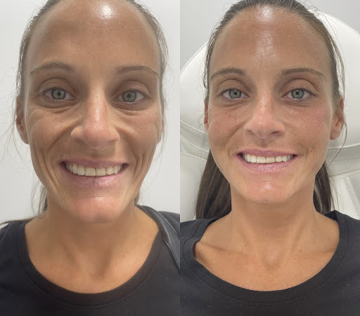 Explore face tattoo ideas female, creative tattoo ideas in Owensboro, available at The Skin Lab