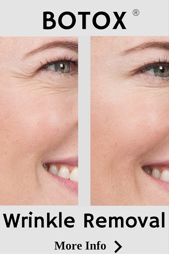 Explore chiefs tattoo ideas, creative tattoo ideas in Boise, available at Spa 35 Med Spa