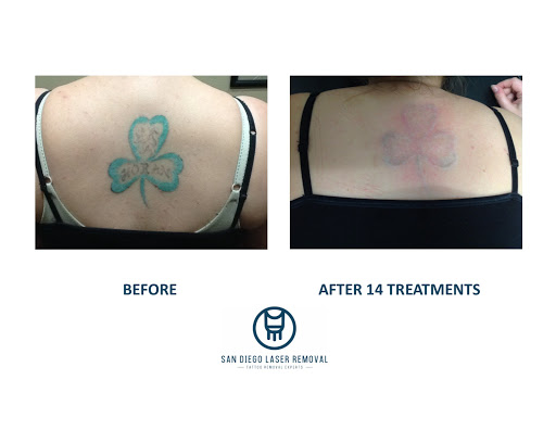 Explore forearm tattoos ideas, creative tattoo ideas in San Diego, available at Removery Tattoo Removal & Fading