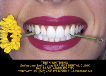 Winsome Smile Today - Winsome Smile Today